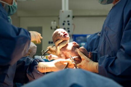 Baby being born via cesarean section